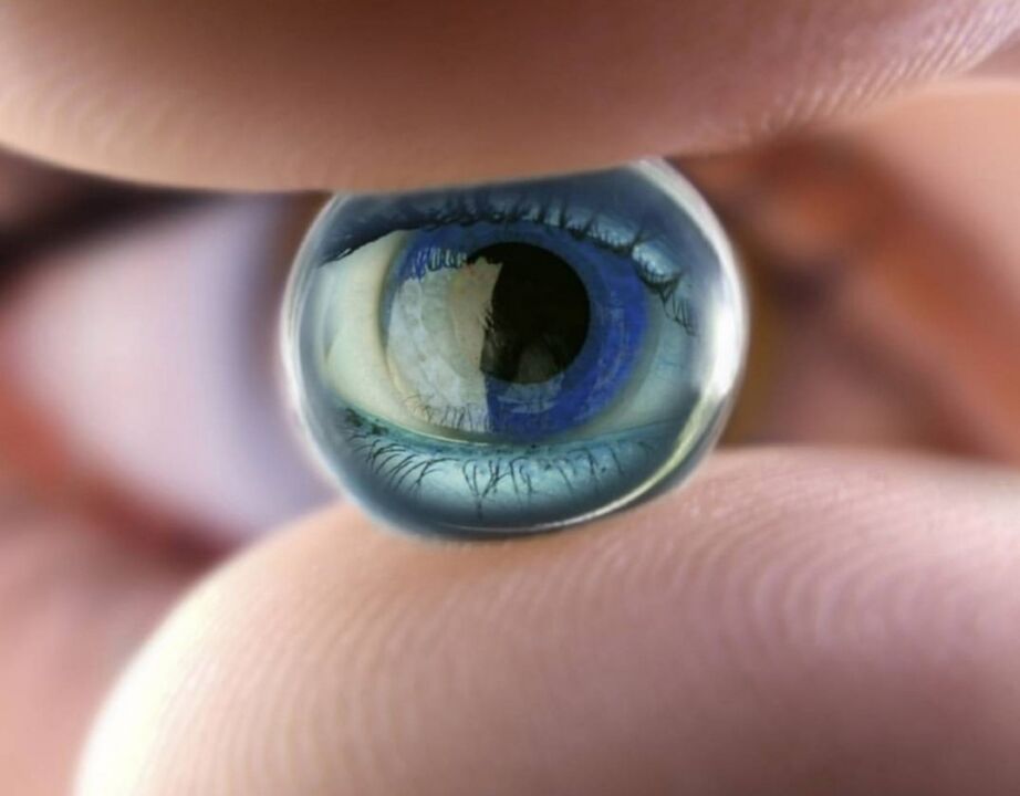 Orthokeratological night lenses stop the progression of visual impairment
